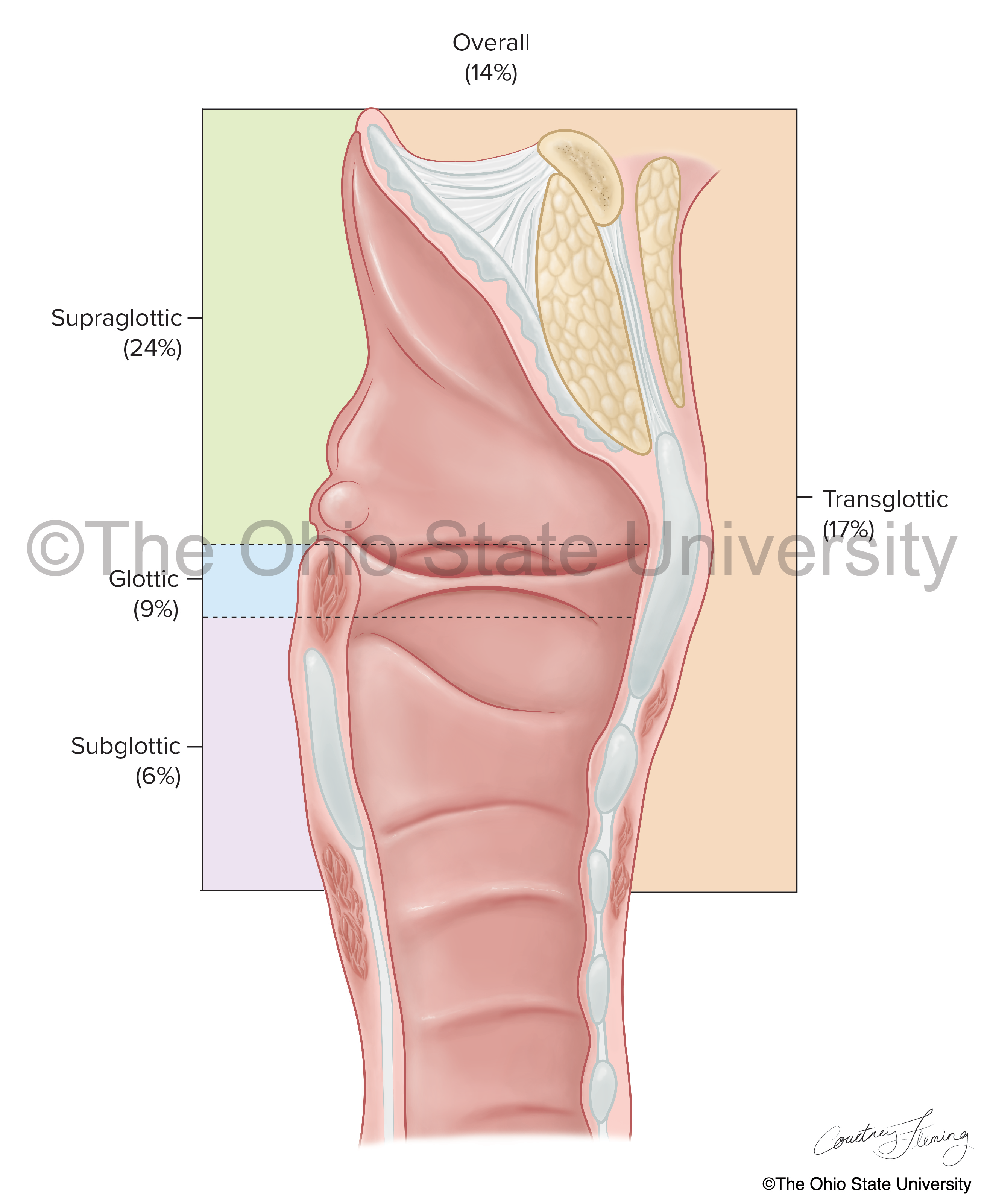 Moderate color journal illustration, showing sagittal cross-section of larynx