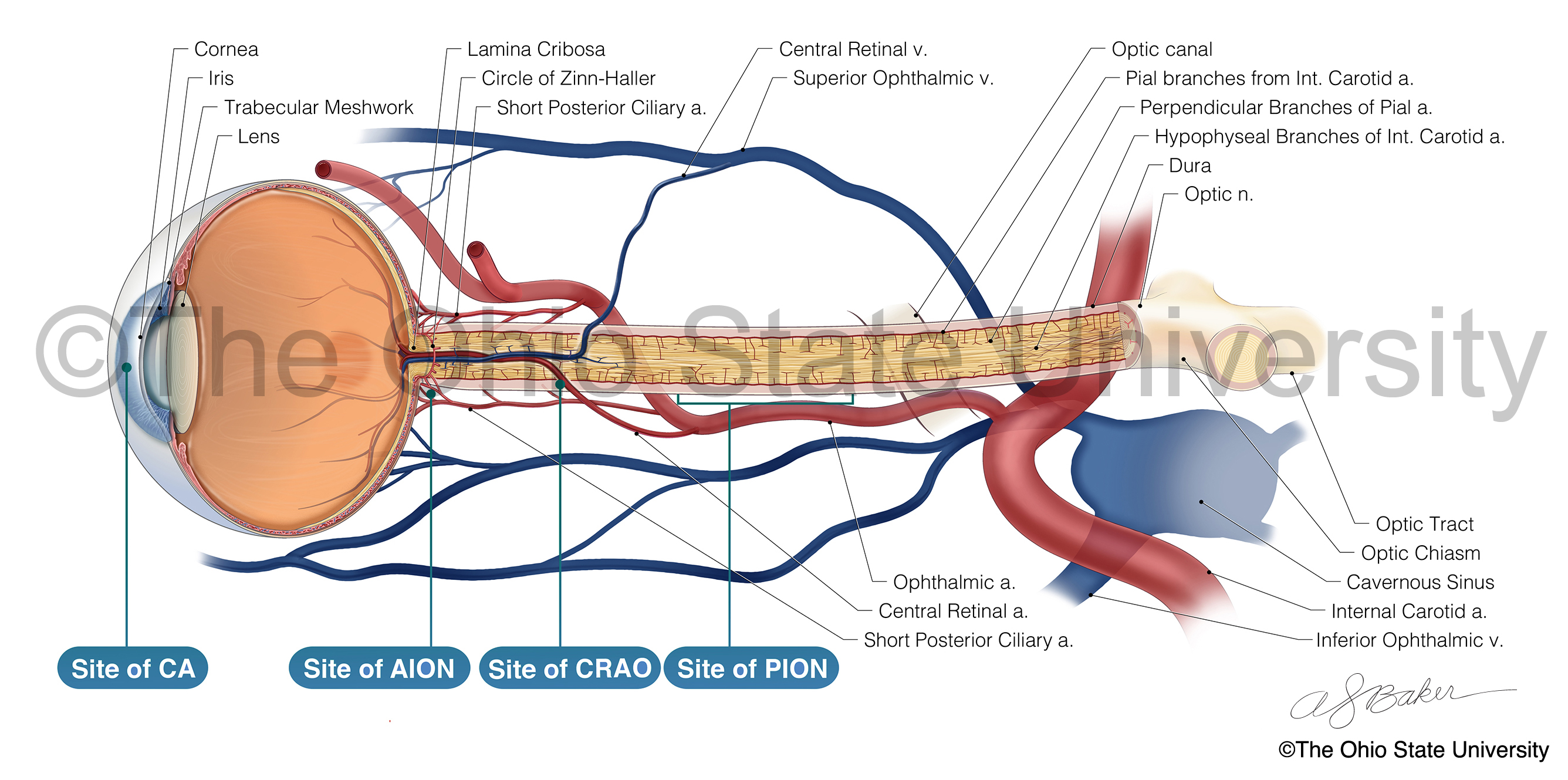 Moderate color neurosurgical journal illustration, showing blood supply to the optic nerve and eye