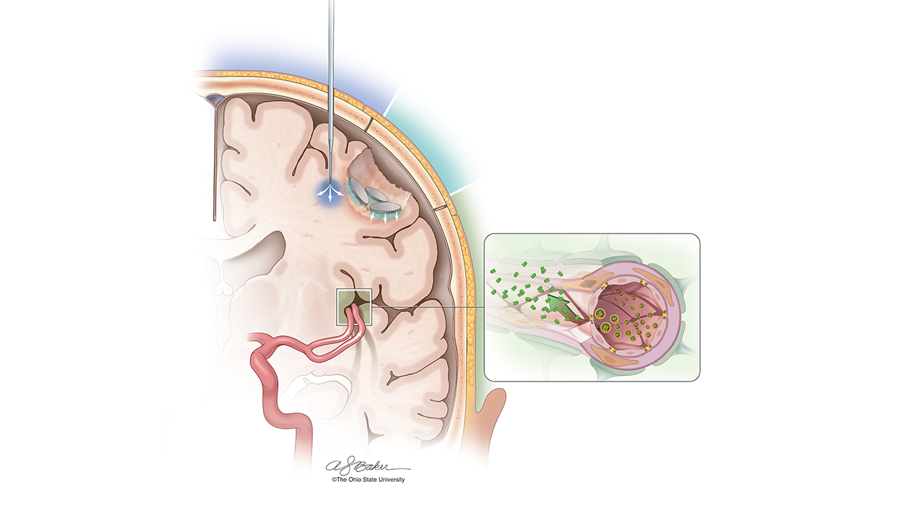 Complex colored medical illustration showing layers and textures of organs.