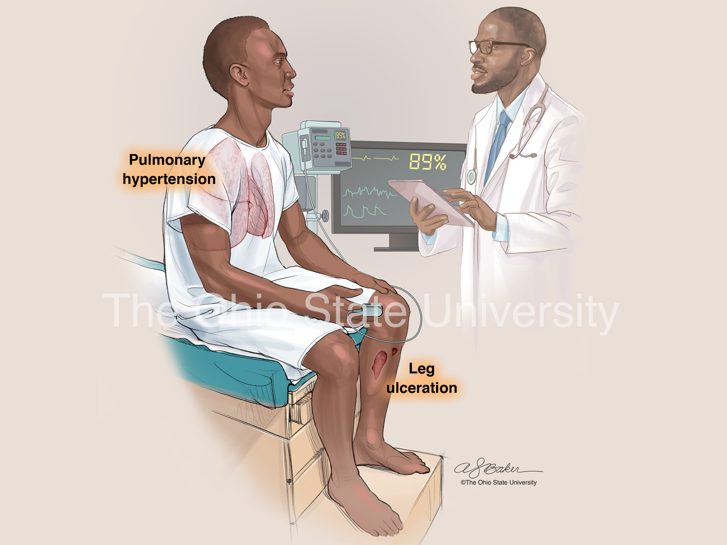 •	Clinical complications related to sickle cell disease (complex color)